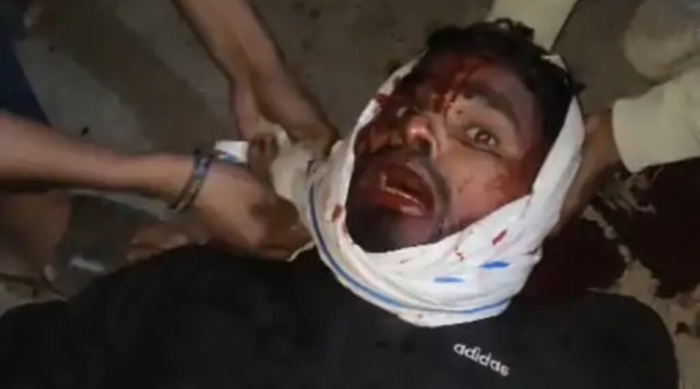 युवक पर धारदार हथियार से हमला, दो संदिग्ध पुलिस हिरासत में