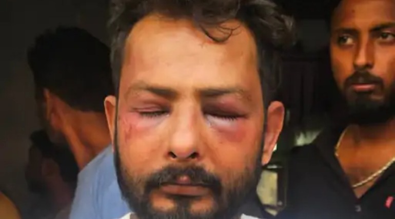 विश्व हिंदू परिषद के नगर अध्यक्ष पर दबंगों ने किया हमला, पुरानी रंजिश में रॉड से पीटा, दोनों आंखें पर गंभीर चोट